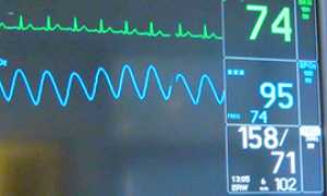 corta monitor cardiologia